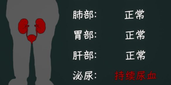 中国式网游病死结局前置条件介绍